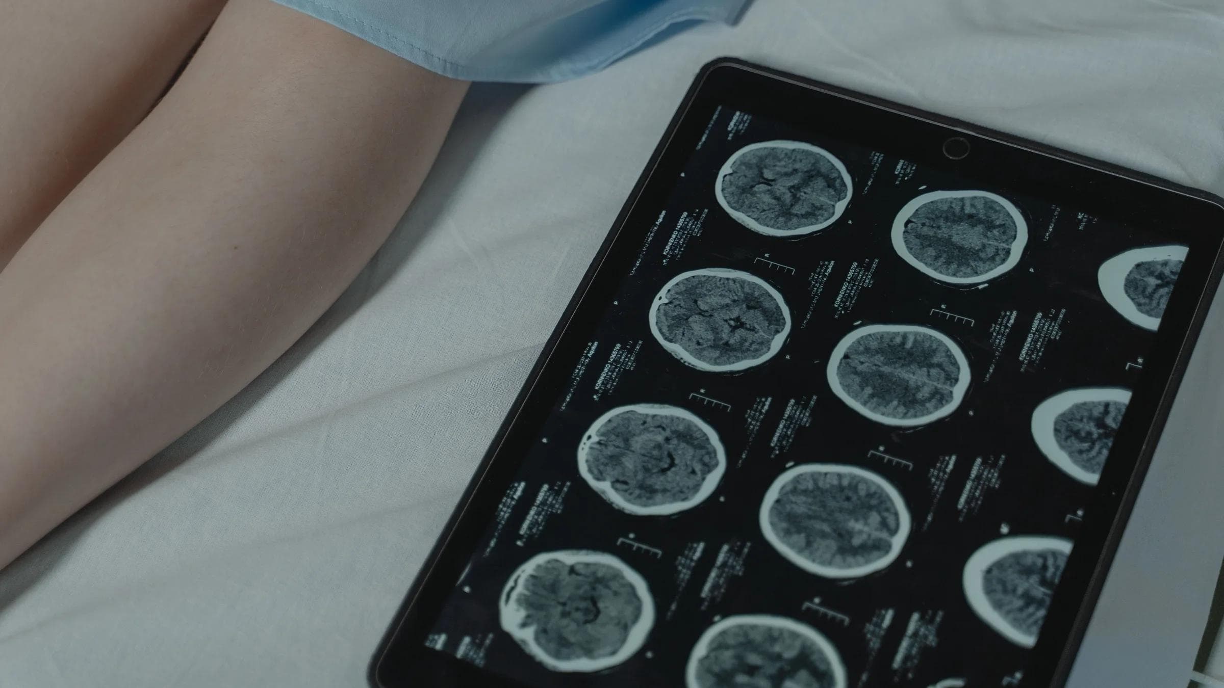 Close-up of brain CT scan display on tablet beside patient's legs in a hospital room.