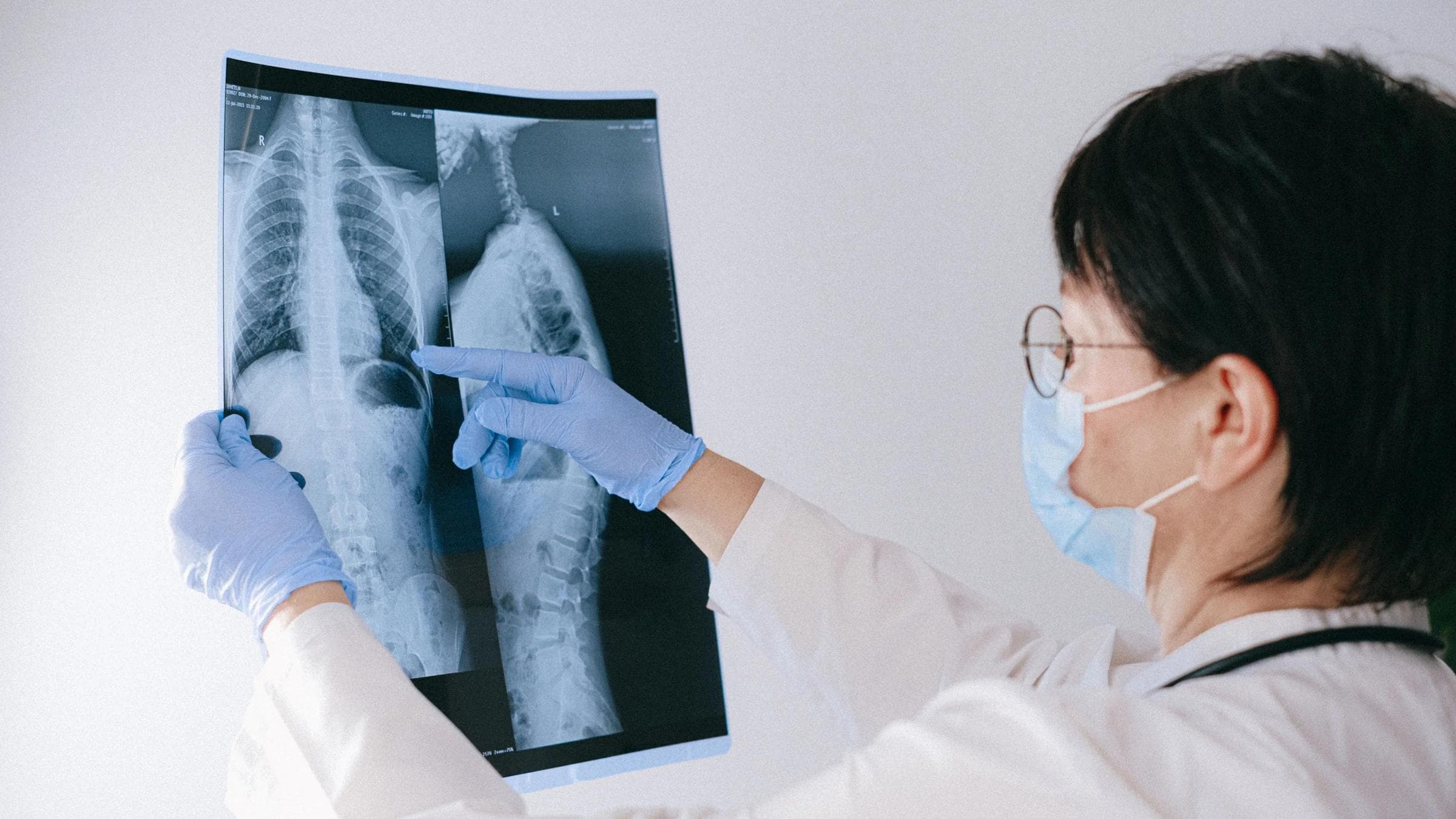 Medical professional reviewing an X-ray, emphasizing healthcare diagnosis and examination.