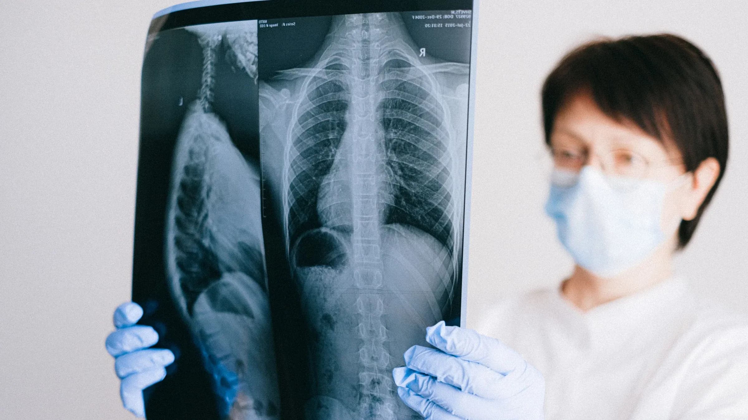 A medical professional analyzes a chest x-ray wearing gloves and a mask in a clinical setting.