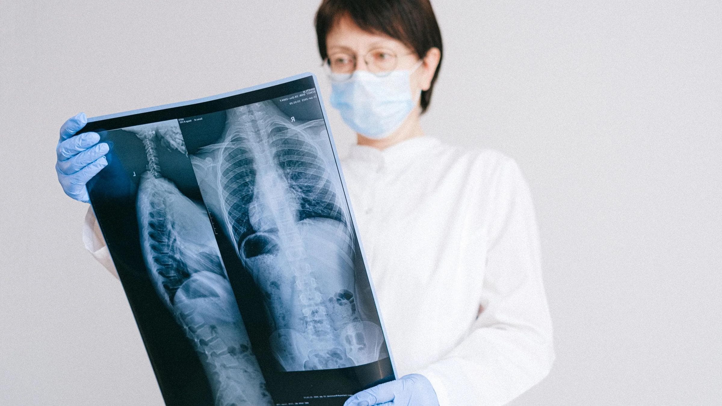 Doctor reviewing X-ray wearing protective gear in hospital setting.